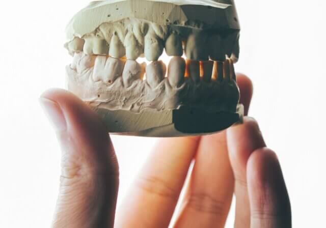 Smile Makeover and Full Mouth Reconstruction