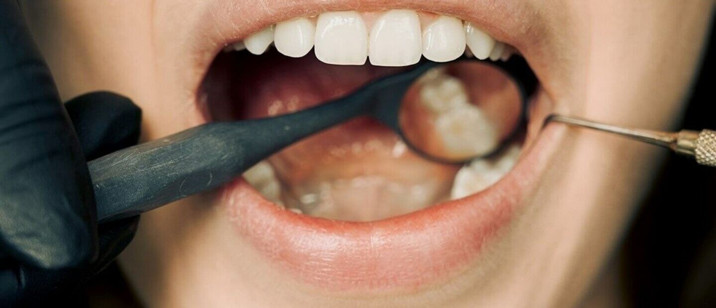Ccsmetic dentistry at Kelowna Dental Centre