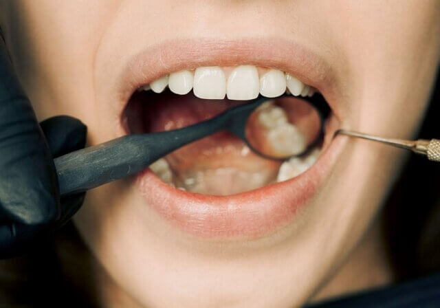 Ccsmetic dentistry at Kelowna Dental Centre