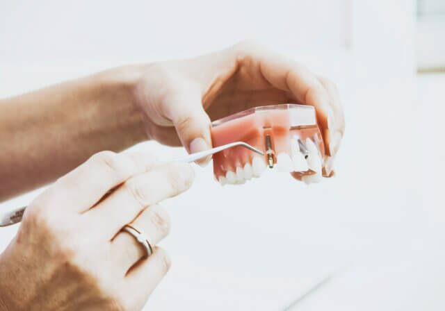 Are dental implants painful?