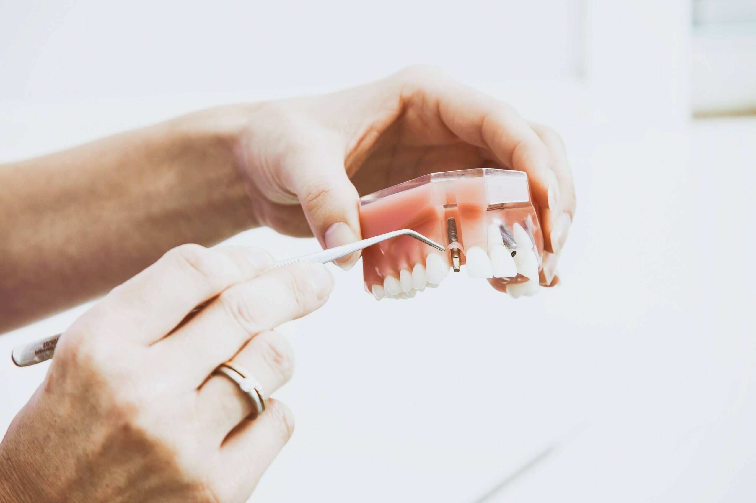 Are dental implants painful?
