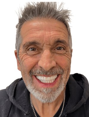 Andy Miller after New Teeth Today dental implants