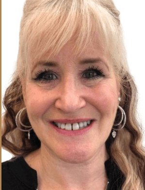 Cindy before dental implants - Kelowna Dental Centre