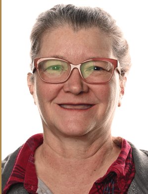 Holly Smith before dental implants - Kelowna Dental Centre