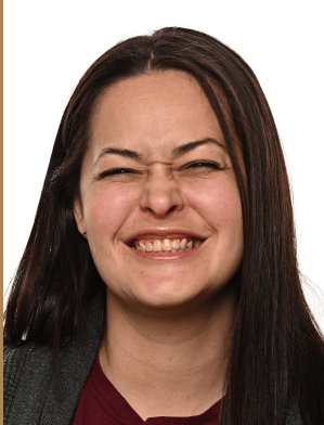 Jamie Collins before dental implants - Kelowna Dental Centre