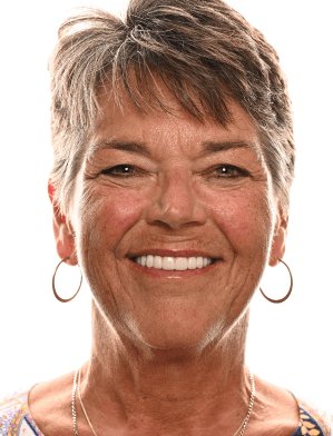Karin Koehle after New Teeth Today dental implants