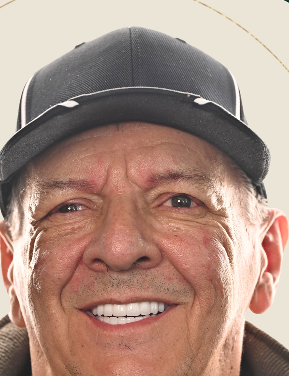Lee Rieger after New Teeth Today dental implants