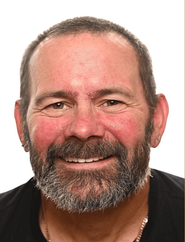 Roary McFadden after New Teeth Today dental implants